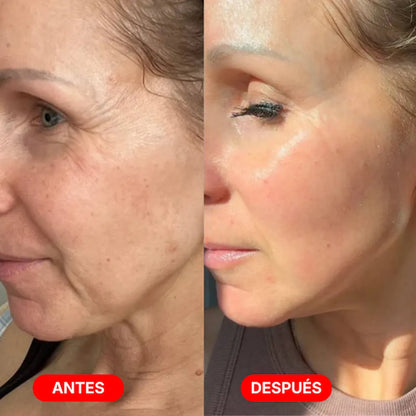 Escultor Lifting Facial 7 en 1 | CollagenLigth™