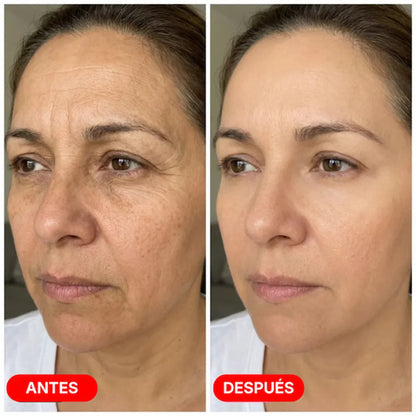 Escultor Lifting Facial 7 en 1 | CollagenLigth™