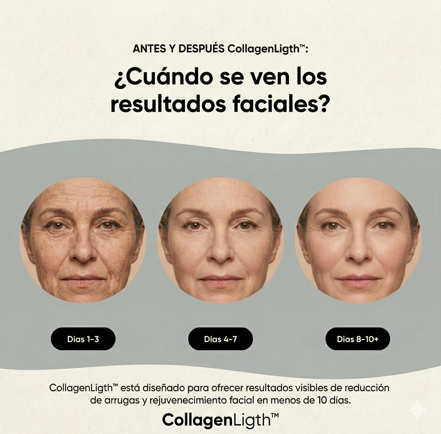 Escultor Lifting Facial | CollagenLigth™