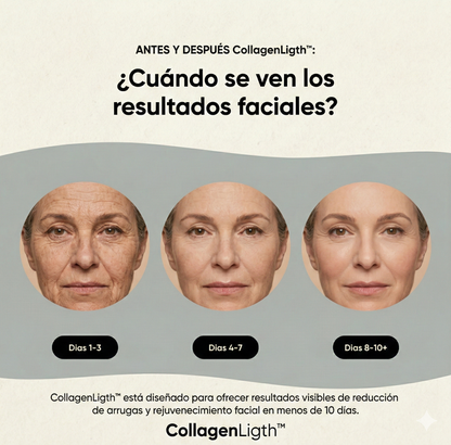 Escultor Lifting Facial | CollagenLigth™