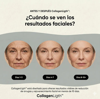 Escultor Lifting Facial 7 en 1 | CollagenLigth™