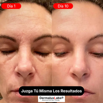 Escultor Lifting Facial 7 en 1 | CollagenLigth™